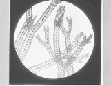 Algoe-Polysiphonia fastigiata, x35.