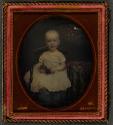 [Child holding strands of hair (chlid possibly has alopecia areata)]