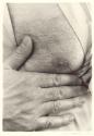 The Act of Exposing a Sensitive Surface