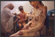 Self-Immolation in Afghanistan: A Cry for Help