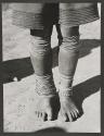 [Xosa girl with leg bracelets]