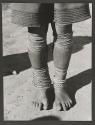 [Xosa girl with leg bracelets]