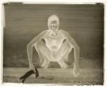 Leper at Tulagi