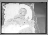 1912 NY/ Tubercular Baby