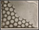 [Photomicrograph]