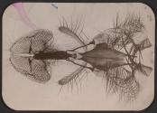 [Photomicrograph of an insect]