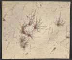 Typhoid flagella