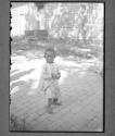 [Child with rickets]