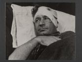 [Man in bed with bandages on his head.]