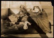 [Open air tuberculosis treatment]