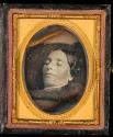 [Postmortem of woman]