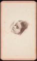 [Postmortem of girl]
