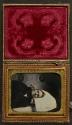 [Postmortem of man]