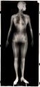 [Full body X-Ray of woman, head facing forward, shoes with metal rods in heels]