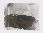 [Postmortem of a baby]