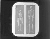 Skelton-Normal Man and Giant