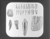Teeth Structure