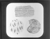 Longtitudinal and tranverse sections of bone, Lacunae and canalieuli