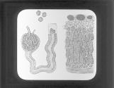 Human Malpighian corpuscle & transverse sect of supra-renal capsule