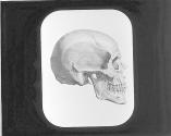 Skull-Side View.
