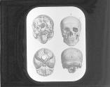 Skull-Front, Back, Base Interior.