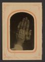 [Hands]