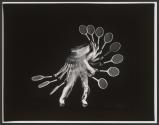 Wrist Firm, Racket Square [Tennis Instructional, Doubles Return of Serve B3]