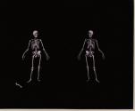 Two Skeletons.