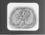 Transverse Section Of The Thorax
