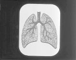 [Diagram Of The Lungs]