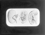 Kidneys