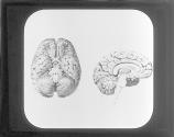 [Brain-Under Surface And Section]