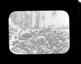 Wounded British troops in trenches