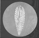Spiracle of Blow Fly